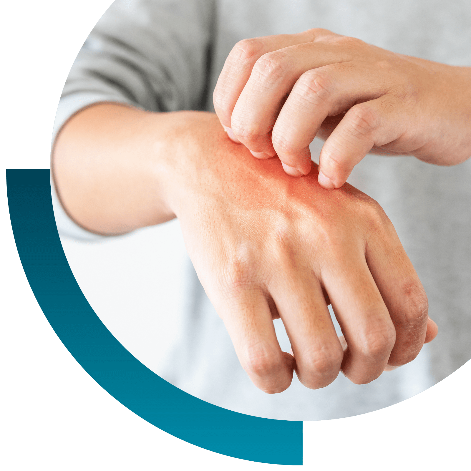 kratzende Hand