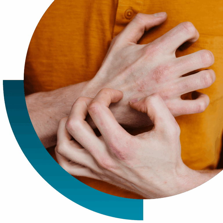 kratzende Hand