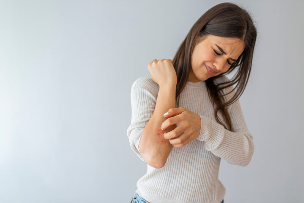 Psoriasis Patientin, die Rötungen an ihrem Arm hat.